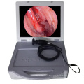 Portable Medical HD Endoscope Camera